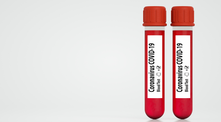 Coronavirus test tubes Covid-19